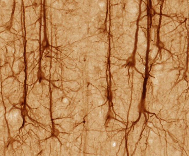 La neuroplasticité : ce que le cerveau peut vraiment réorganiser