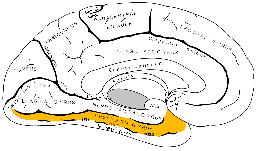 La prosopagnosie : quand le cerveau ne reconnaît plus les visages